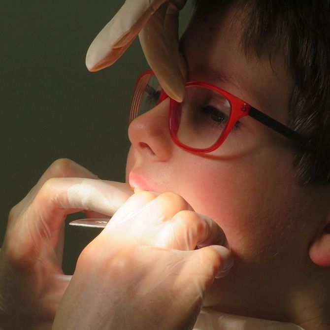 La ortodoncia infantil: ¿qué debes saber?