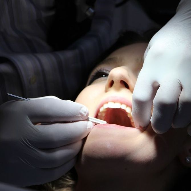 La periodontitis y los implantes dentales