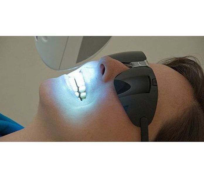 Blanqueamiento dental  : Servicios de Clínica Dental Dra. Belkys Hernández Cabrera