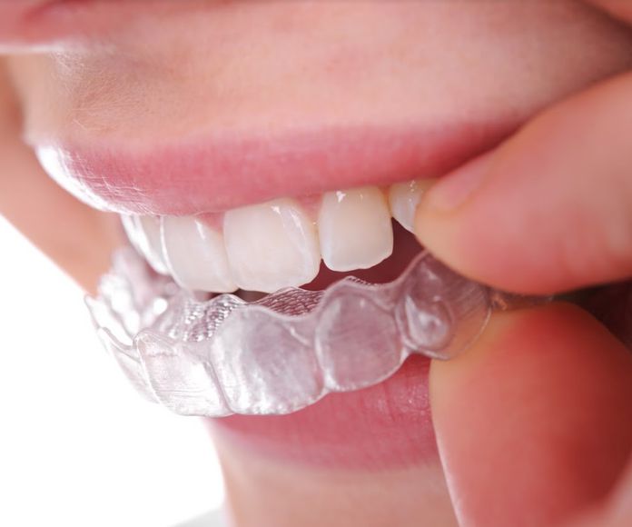 Ortodoncia invisible (Invisaling): Servicios  de Clínica Dental Sanclemente
