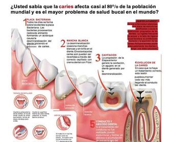 Endodoncia: Tratamientos de Clínica Dental García Villagrá