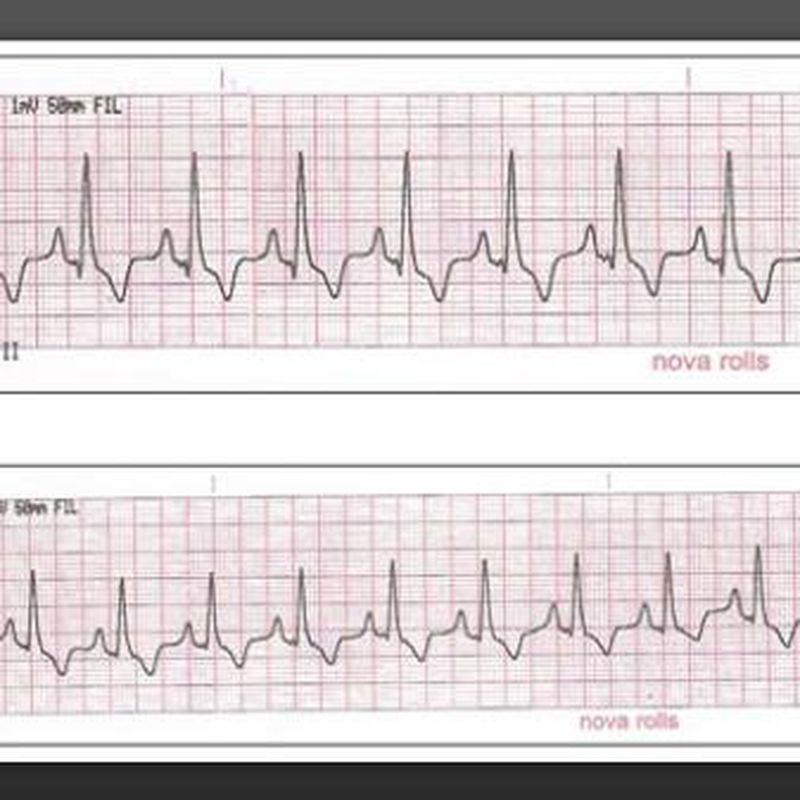 Cardiología: Servicios de Clínica Veterinari Sant Antoni Abat