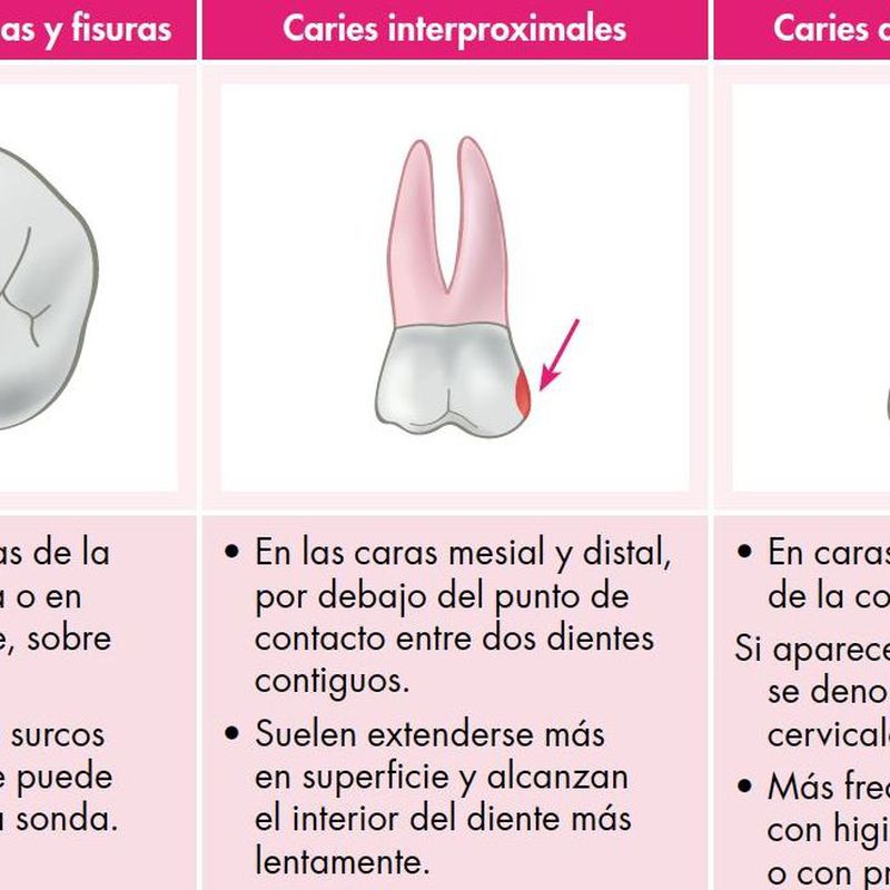 Odontología general: Tratamientos de Clínica Dental García Villagrá