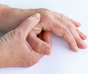 Tratamiento de artrosis: Un enfoque innovador con medicina biológica-integrativa