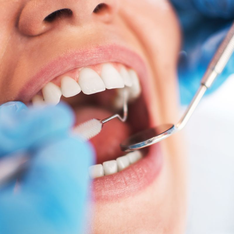 Endodoncias: Tratamientos de Clínica Dental Espartales - José Antonio Narváez