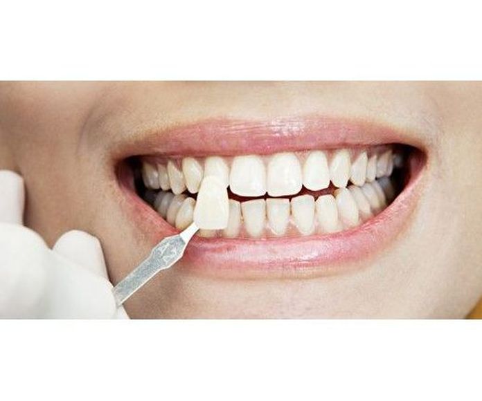 Estética dental: Tratamientos de Dential