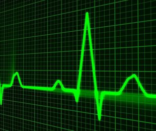 Electrocardiograma veterinario