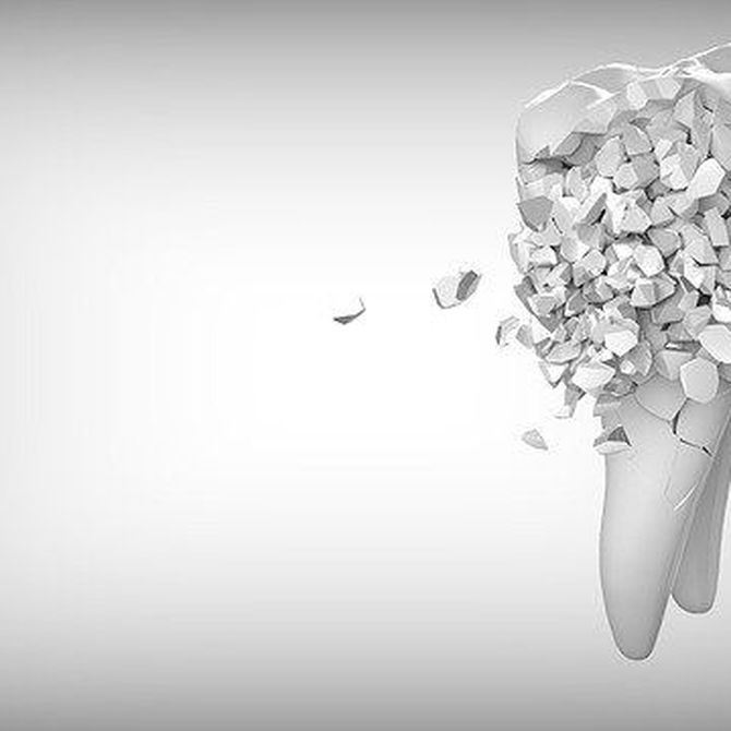 Descalcificación de los dientes