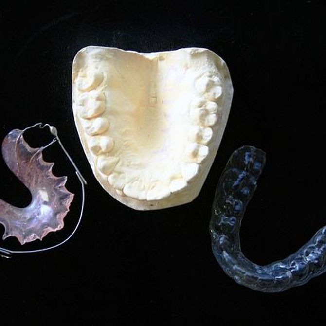 ¿Por qué usar ortodoncia invisible?