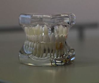 Odontología : Tratamientos de Clínica Dental Herpaden