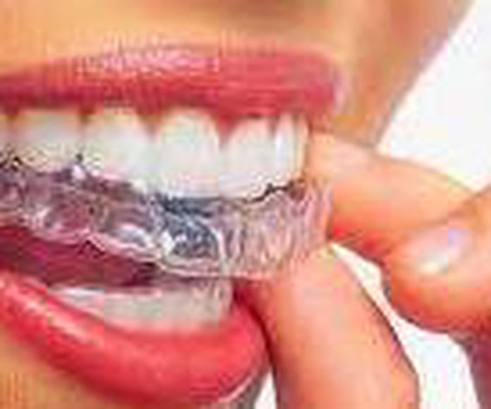 Ortodoncia invisible Invisalign: Tratamientos de Clínica dental Neardental }}