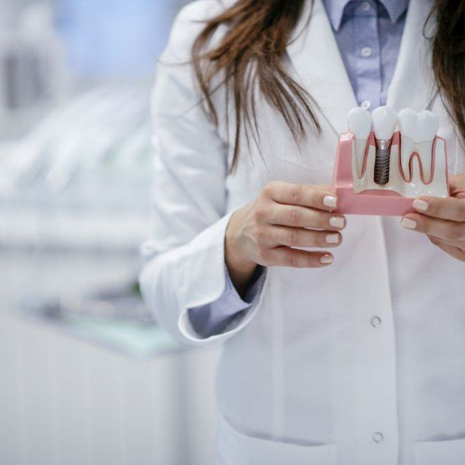 ¡Sonríe sin preocupaciones! Implantes dentales a precios irresistibles