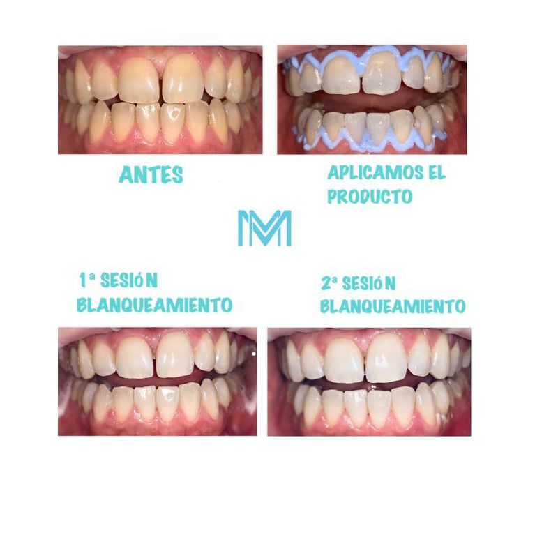 Estética dental: Servicios de Marta Martínez Clínica Dental
