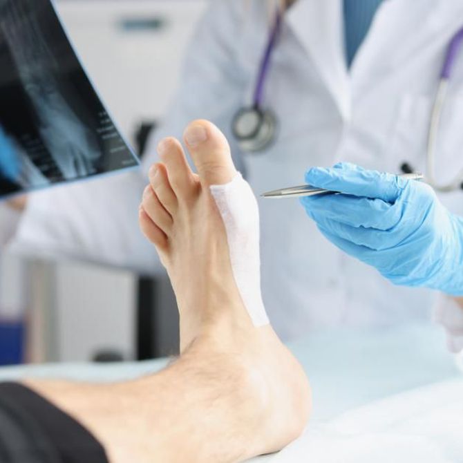 Principales causas de la cirugía del pie