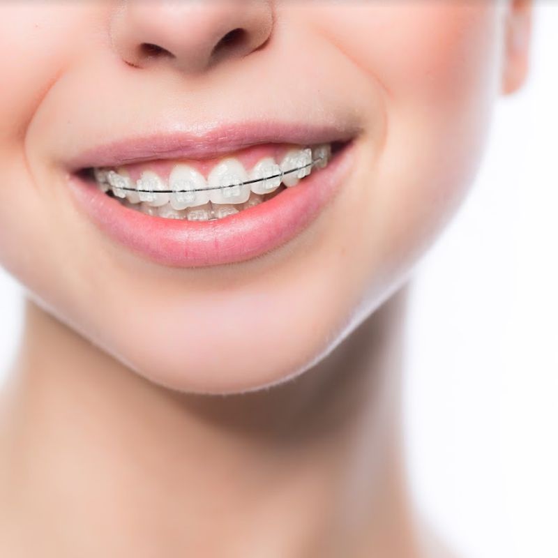 Ortodoncia: SERVICIOS de Altes Dental