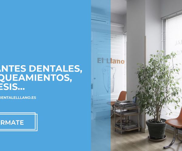 Aparatos dentales Gijón