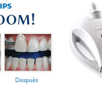 Higiene dental: Tratamientos de Clínica Dental Dra. Carretero