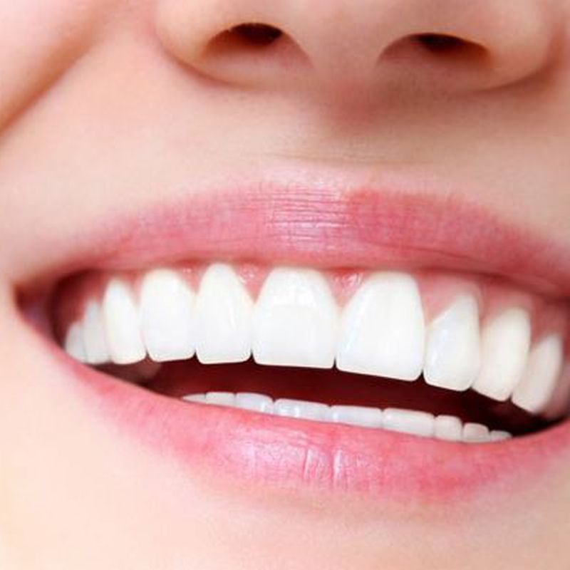 Estética dental: Servicios de Clínica Sasermed Dental Buhaira