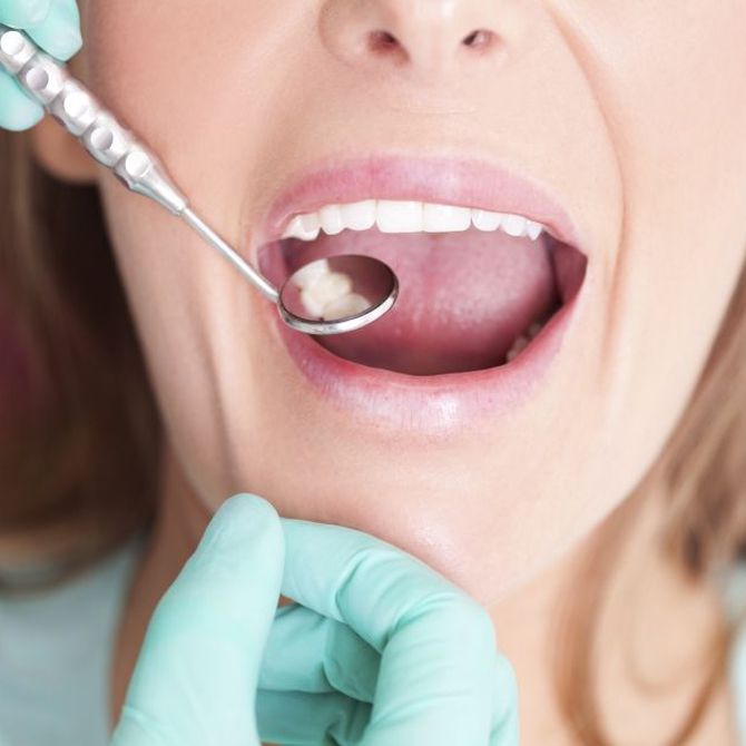 Cuáles son las urgencias dentales más frecuentes