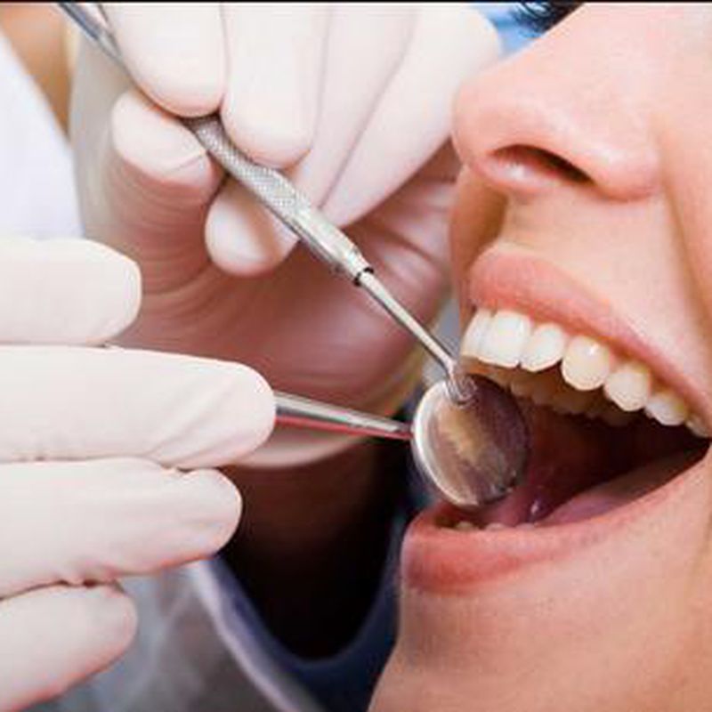 Odontología General: Servicios de Clínica Dental Safident