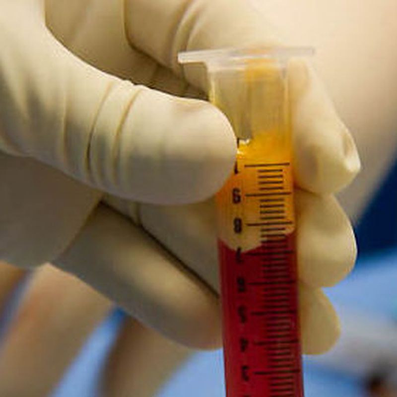 HERPES VIRUS TIPO 2 (GENITAL) ANTICUERPOS: Ofrecemos de Laboratorios Ruiz-Falcó