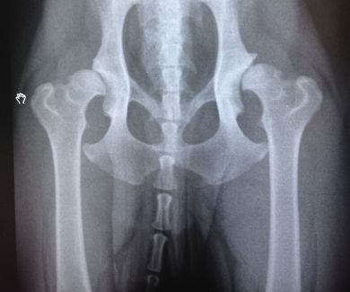 Importancia de la radiografía preventiva de cadera