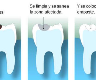 Ortodoncia lingual: Tratamientos de Hospident Clínica Dental