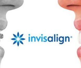 Ortodoncia invisible Invisalign