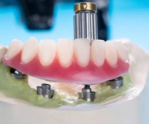 Consejos para el cuidado de tus prótesis dentales