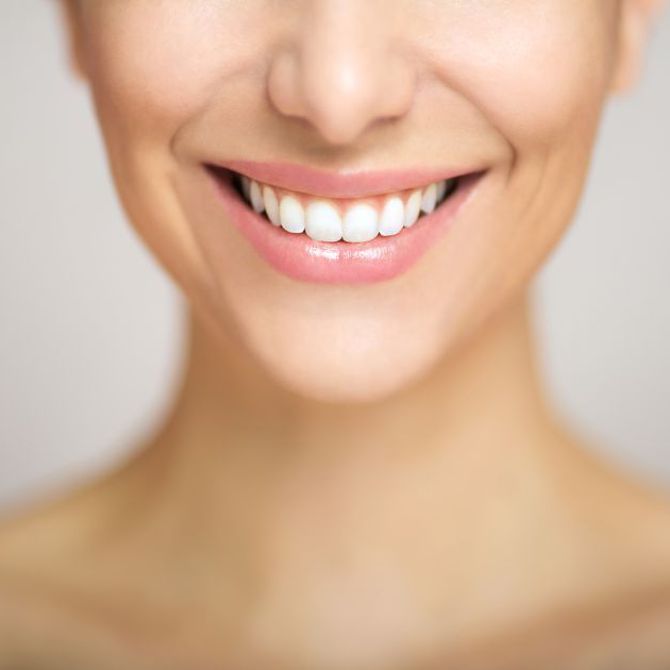 El tratamiento de blanqueamiento dental