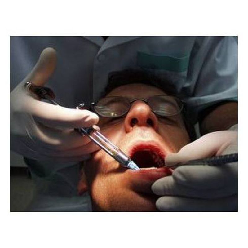 Periodoncia: Productos y servicios de Clínica Dental Carlos Michelon