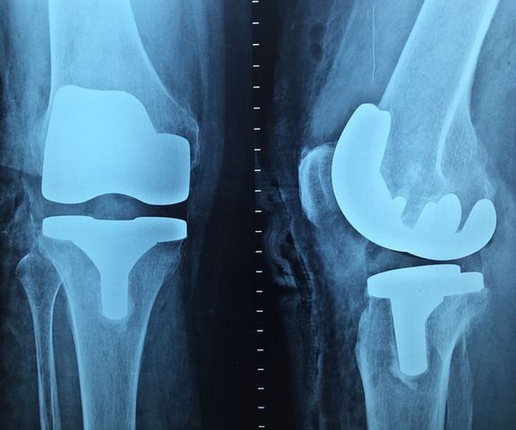 Breve historia de la ortopedia