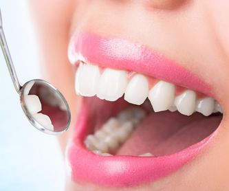 Ondontología estética: Tratamientos de Clínica Dental Quart