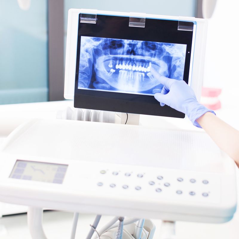 Ortopantomografía: Nuestros Servicios de Bonestar Clínica Dental