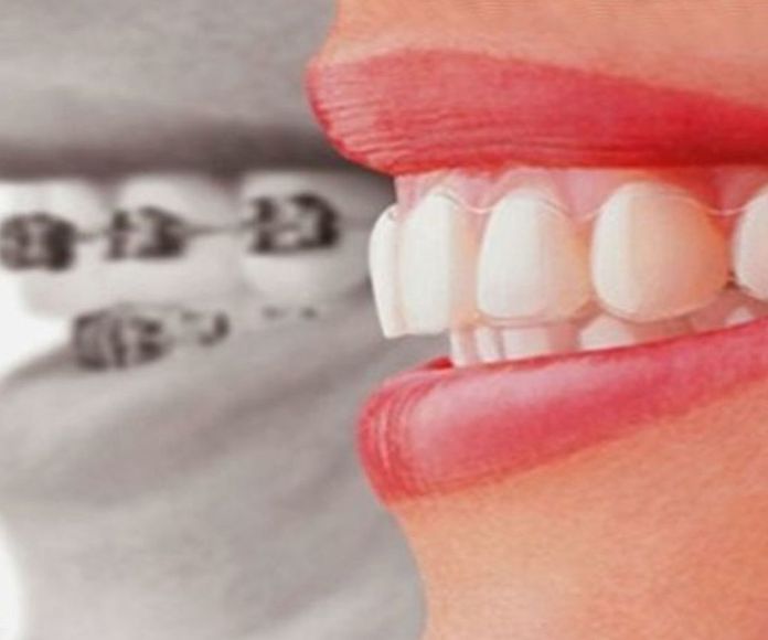 Dentífricos, ¿Cuál debo usar y por qué?