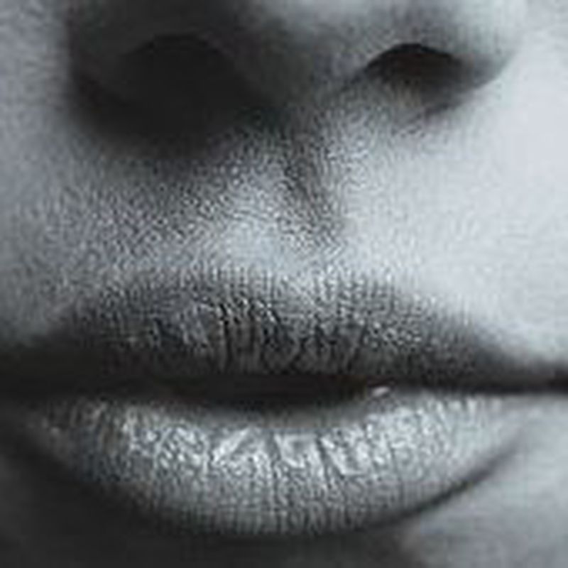 Remodelación de labios: Tratamientos de Palma Estetic Dr. Antonio Jiménez Martorell