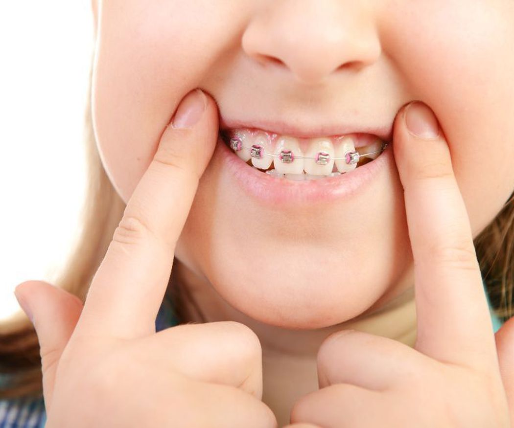 Principales problemas dentales en la infancia