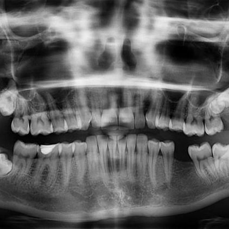 Odontología general: Tratamientos dentales de Garrido Palacios, Mª Cruz