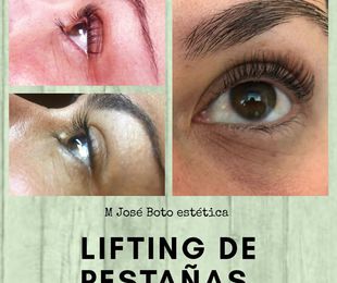 Lifting de pestañas 