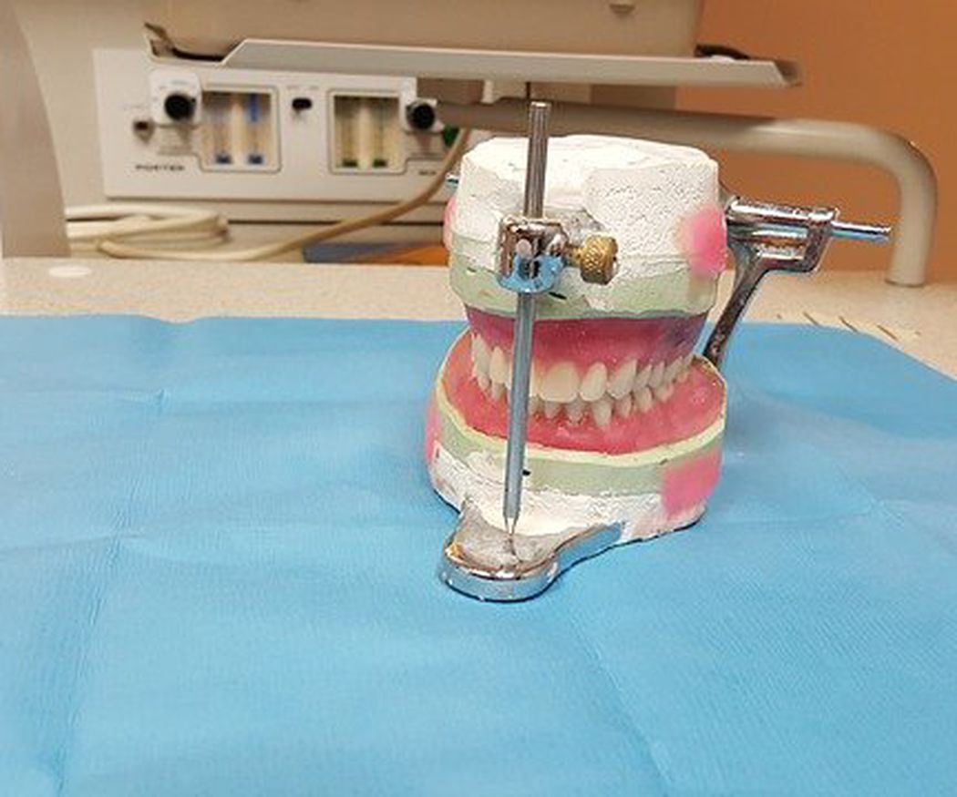 ¿Cómo mantener limpia tu prótesis dental?