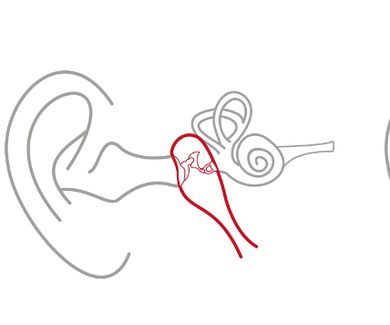 ¿Cómo funciona la audición?