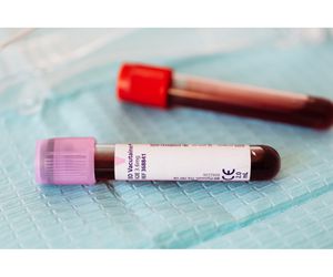 El revolucionario análisis de sangre que detecta hasta 50 tipos de cáncer: el hallazgo científico