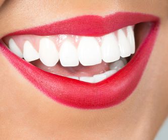 Estética dental: Servicios de Clínica Dental Coll Favà