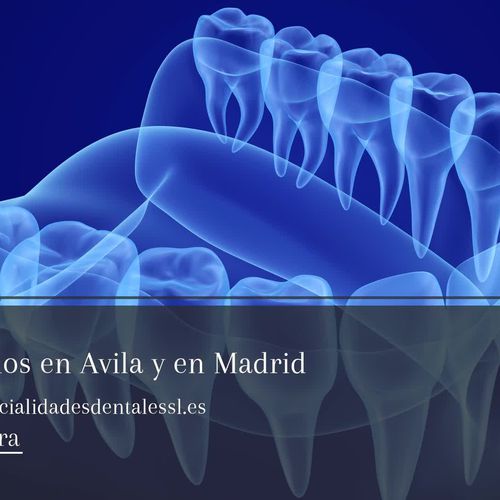 Clínica dental en Ávila | Clínica Especialidades Dentales