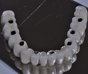 Recomendaciones sobre el cuidado de los implantes dentales