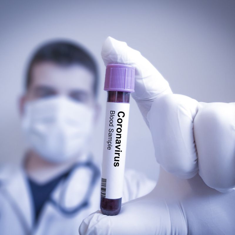 Test Covid: Servicios de Centro Médico Fuengirola
