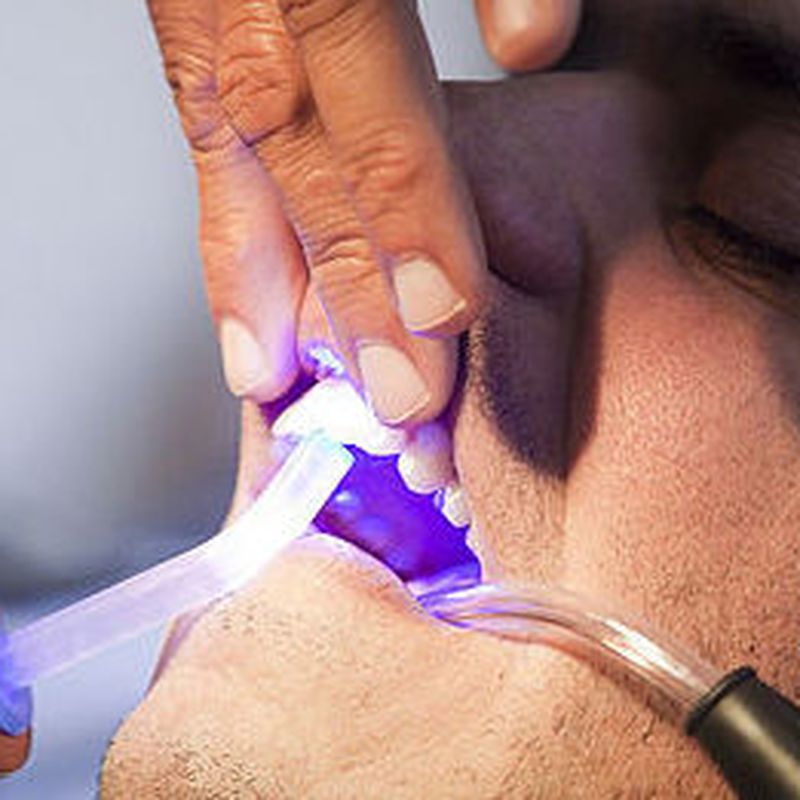 Endodoncia: Tratamientos de Clínica Dental Palamadent