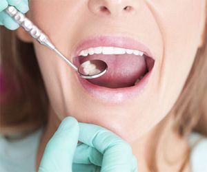 Tratamientos dentales en Palencia