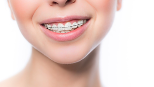 Imagen de SERVICIOS - Ortodoncia