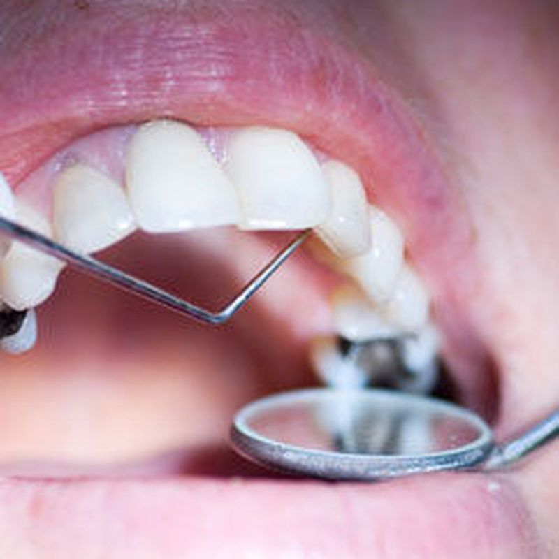 Tratamientos: Tratamientos de Clínica Dental Quintás